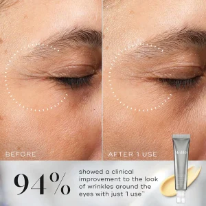 Medik8 Crystal Retinal: πριν και μετά από μία χρήση γύρω από τα μάτια